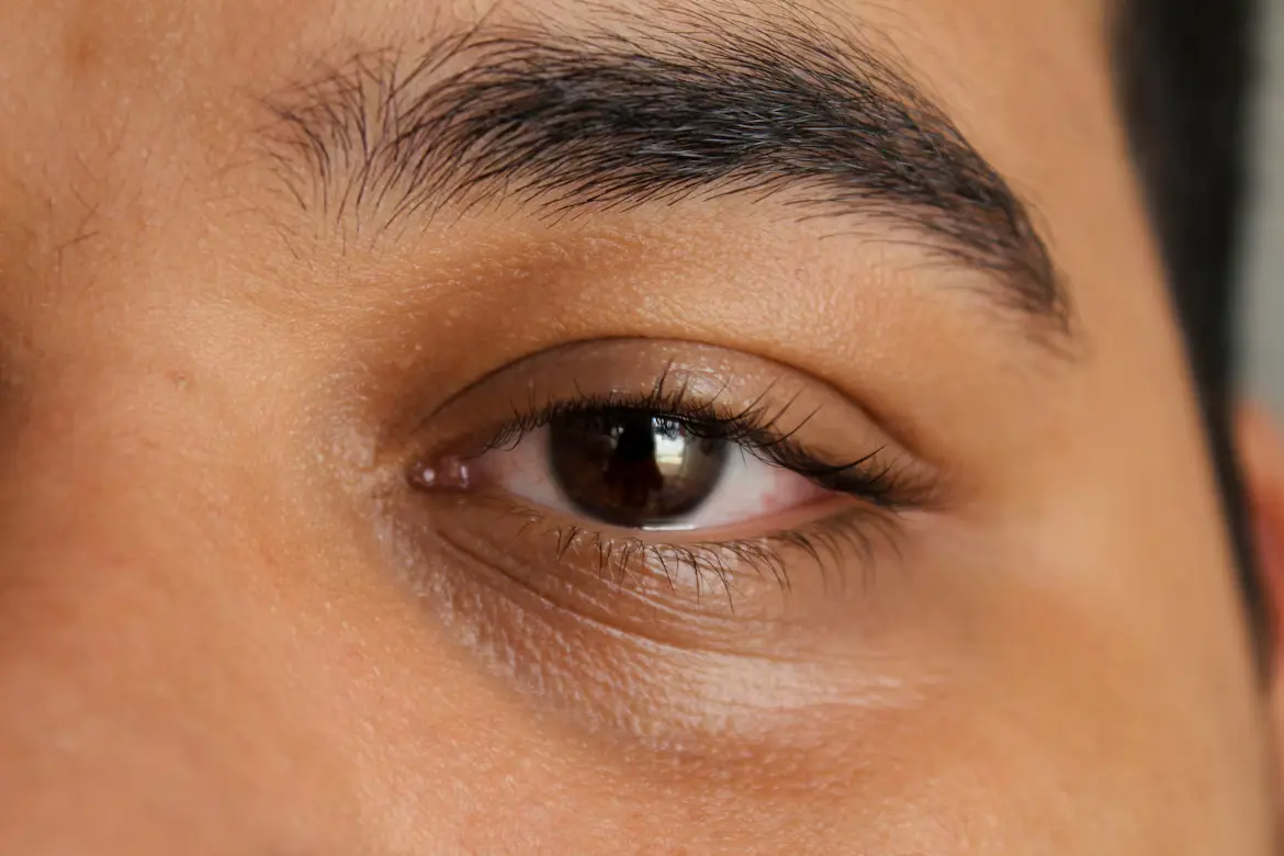 Close-up of dark circles under the eyes before treatment consultation at Strella Medical Aesthetics.